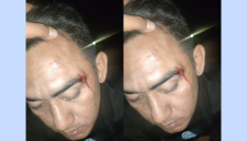 Seorang pria bernama Hamdi (34), warga Desa Meddelan, diduga menjadi korban pemukulan brutal (Za - garudajatim.com)
