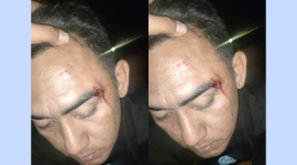 Seorang pria bernama Hamdi (34), warga Desa Meddelan, diduga menjadi korban pemukulan brutal (Za - garudajatim.com)