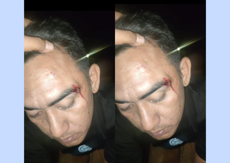 Seorang pria bernama Hamdi (34), warga Desa Meddelan, diduga menjadi korban pemukulan brutal (Za - garudajatim.com)